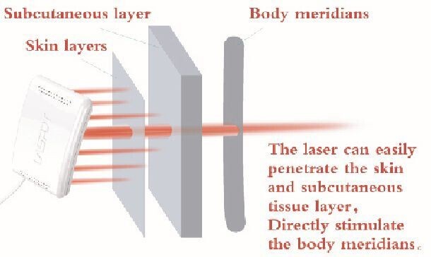 Blutzucker-Viskositäts-Cholesterin-Therapie-Laser-Uhr Hemotherapy Lasers hohes auf der unteren Ebene
