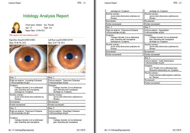 Spätester Digital-Iris-Analyse-Digital Usb-Kamera Alu-Fall hohes Resolusion