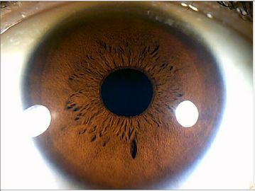 Medizinischer Iris-Bereich Megapixel-Digitalkamera-Augen-Iris-Analysator 12.0MP USB