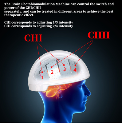 Rtms-Therapie Brain Helmet Transcranial Magnetic Stimulator Photobiomodulation