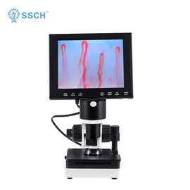 Tragbarer Nailfold-haarartige Diagnosen-Mikrozirkulations-Mikroskop-Durchblutung