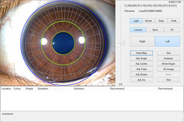 12.0MP Digital Iriscope Iridology Zustimmung der Kamera-Augen-Prüfmaschine-CE/DHL