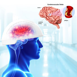 Maschine Neurofeedback-Therapie-Maschinen-Transcranial magnetische Gehirn-Anregung der Lichttherapie-810nm