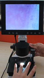 Färben Sie Pixel des Nailfold-Mikrozirkulations-Ausrüstungs-haarartige Mikroskops 380000 mit CER