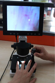 Hochauflösende LCD-Mikrozirkulation, die Mikroskop Nailfold-Videoentdeckungs-Instrument überprüft