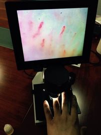 CER-anerkanntes Soem-LCD-Bildschirm-Farbmikrozirkulations-Mikroskop für die Nagel-Prüfung