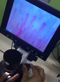Generations-Mikrozirkulations-Mikroskop, Blutgefäß-Mikroskop für Gesundheitswesen