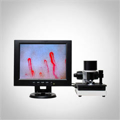 Lcd-Anzeigen-Gesundheits-Analysator-Maschinen-klinisches Blutuntersuchungs-Mikrozirkulations-Mikroskop