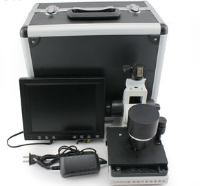 Mikroskop Nailfold-haarartiger Test der Mikrozirkulations-600cd/m2 angeschlossen an Laptop