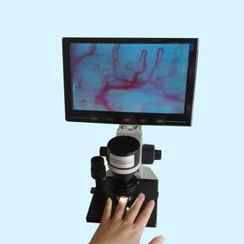 Berufsnailfold-Mikrozirkulations-Mikroskop/Nagel, der Mikroskope überprüft